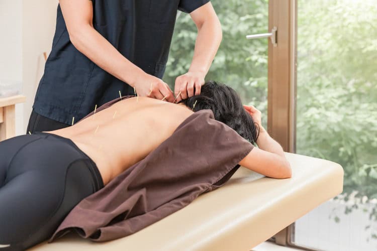 Physio Treatments and Exercises - One Body LDN Acupuncture therapy session for back pain relief
