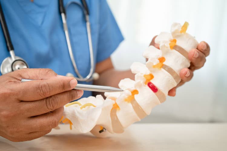 Doctor explaining trapped nerve using human spine model display - One Body LDN Doctor explaining trapped nerve using human spine model display
