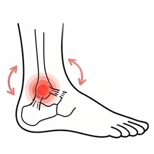 Illustration of ankle pain with inflammation and movement restrictions.
