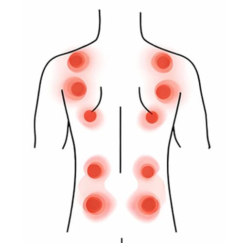 Illustration of common back pain points with red highlights on the back and shoulders.