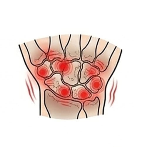 Arthritis-or-Degenerative-Change with red spot indicate pain