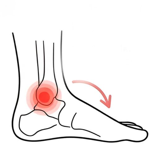 Arthritis-or-Degenerative-Changes with red spot indicate pain