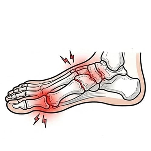 Arthritis-or-Degenerative-Joint-Changes with red spot indicate pain