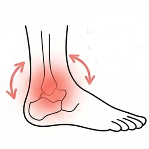 The Ottawa Ankle Rules, Translated