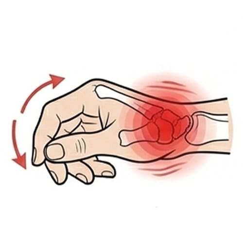 De-Quervain’ with red spot indicate pain