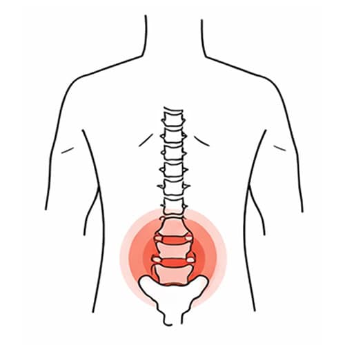 Chronic lower back pain relief and treatment at One Body LDN in London. Expert physiotherapy and spi.
