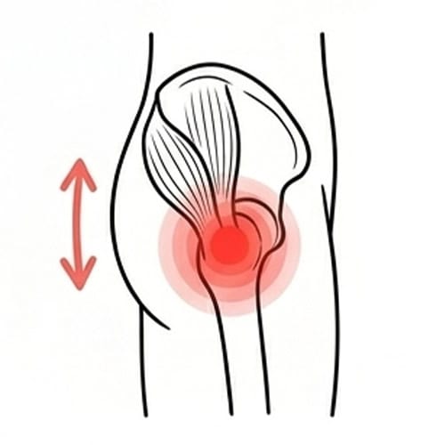 How Hip Joint Pain Shows Up In The Buttocks
