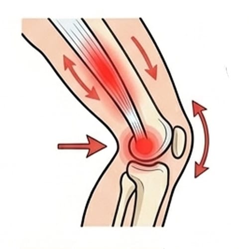 Ligament-Injury with red spot indicate pain