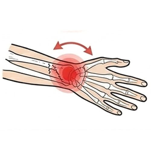 The Three Signals For Everyday Wrist Pain