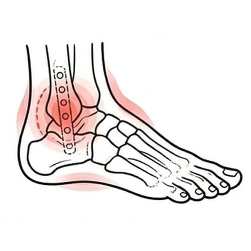 Post Injury with red spot indicate pain