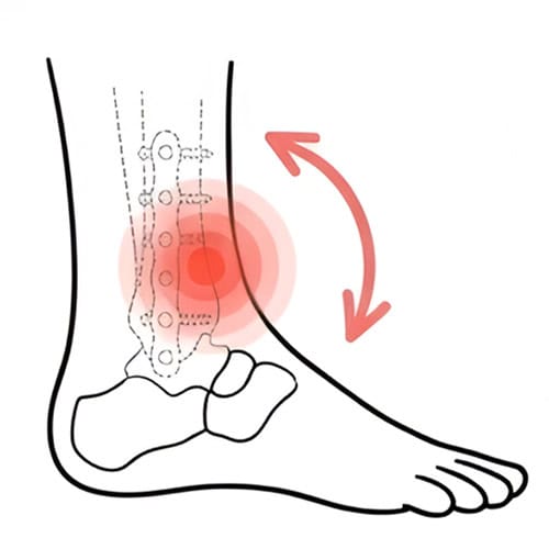 Post‑Fracture with red spot indicate pain