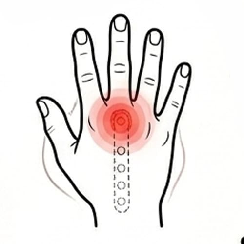 Post‑Injury-or-Post‑Surgery-Pain with red spot indicate pain