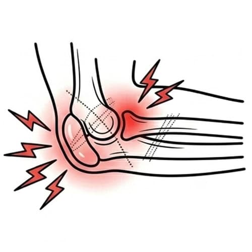 Post‑Injury-or-Post‑Surgical-Elbow-Pain with red spot indicate pain