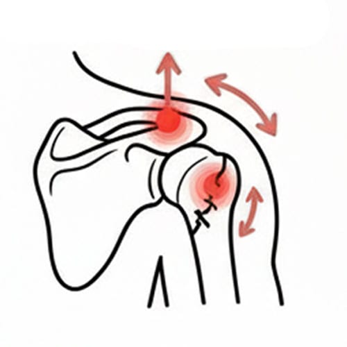 Why Does My Shoulder Hurt More At Night? 