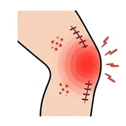 Knee with stitches and red pain indicators colored body