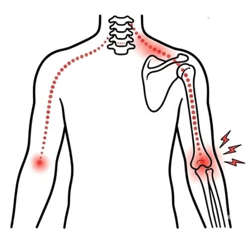 What A Proper Elbow Assessment Includes