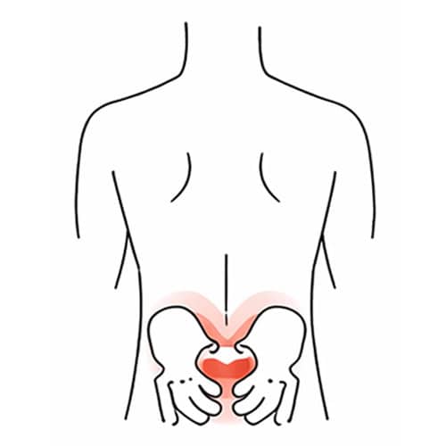 Illustration of lower back and pelvic pain areas for back pain treatment.