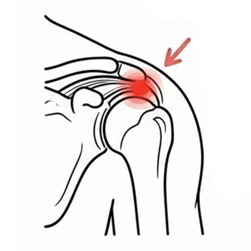 Shoulder-Impingement with red spot indicate pain