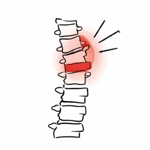 Neck pain highlighted in red with inflammation around cervical spine.