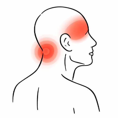 Neck pain highlighted with red areas on the back and side of the head and neck.