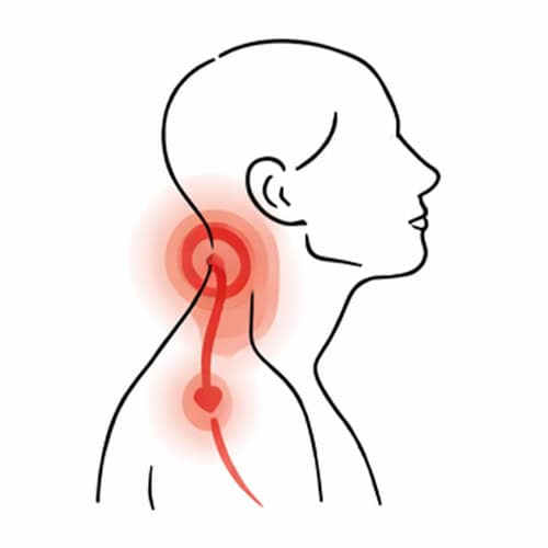Illustration of neck pain with highlighted area on the neck and upper spine.